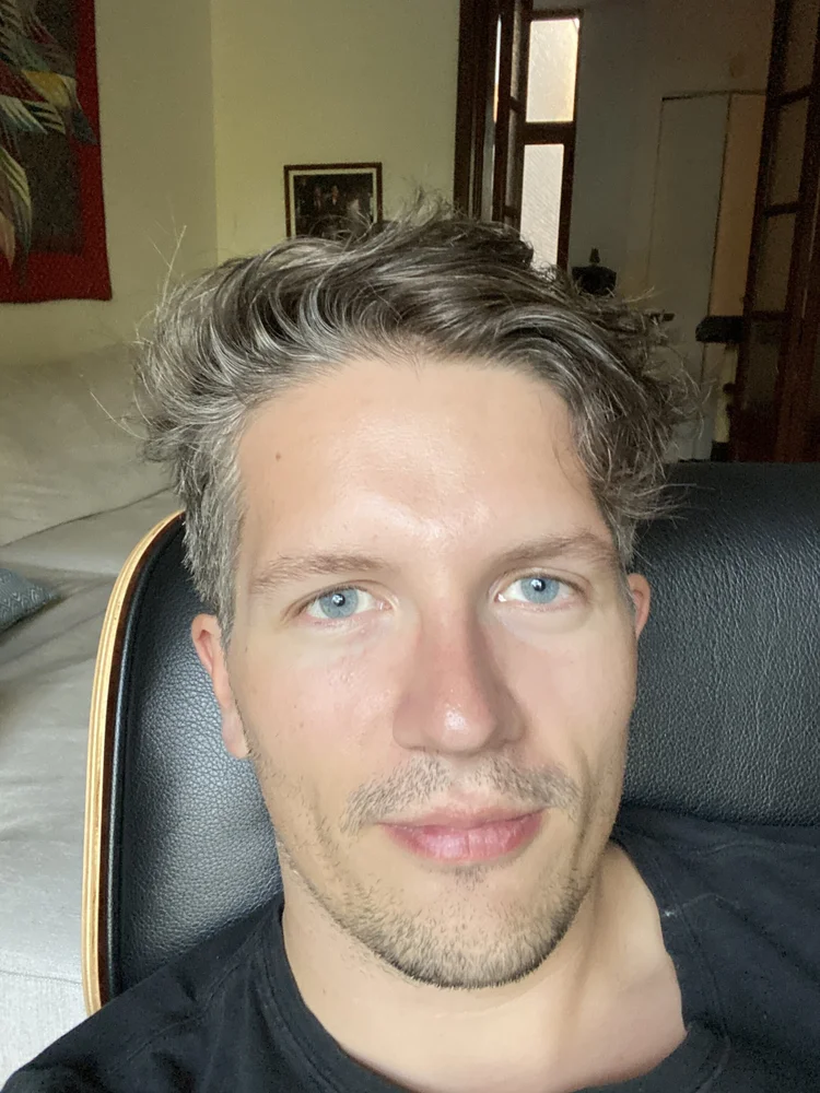 I removed the Quarantine beard